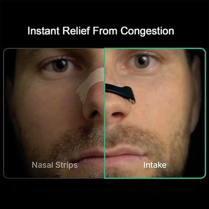 Best nasal strip starter kit(1 set) - external strips | 2025 | fast shipping