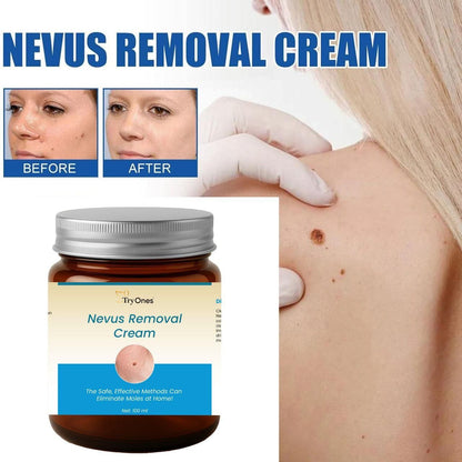 Nevus Removal Cream 200 ml Pack of 2