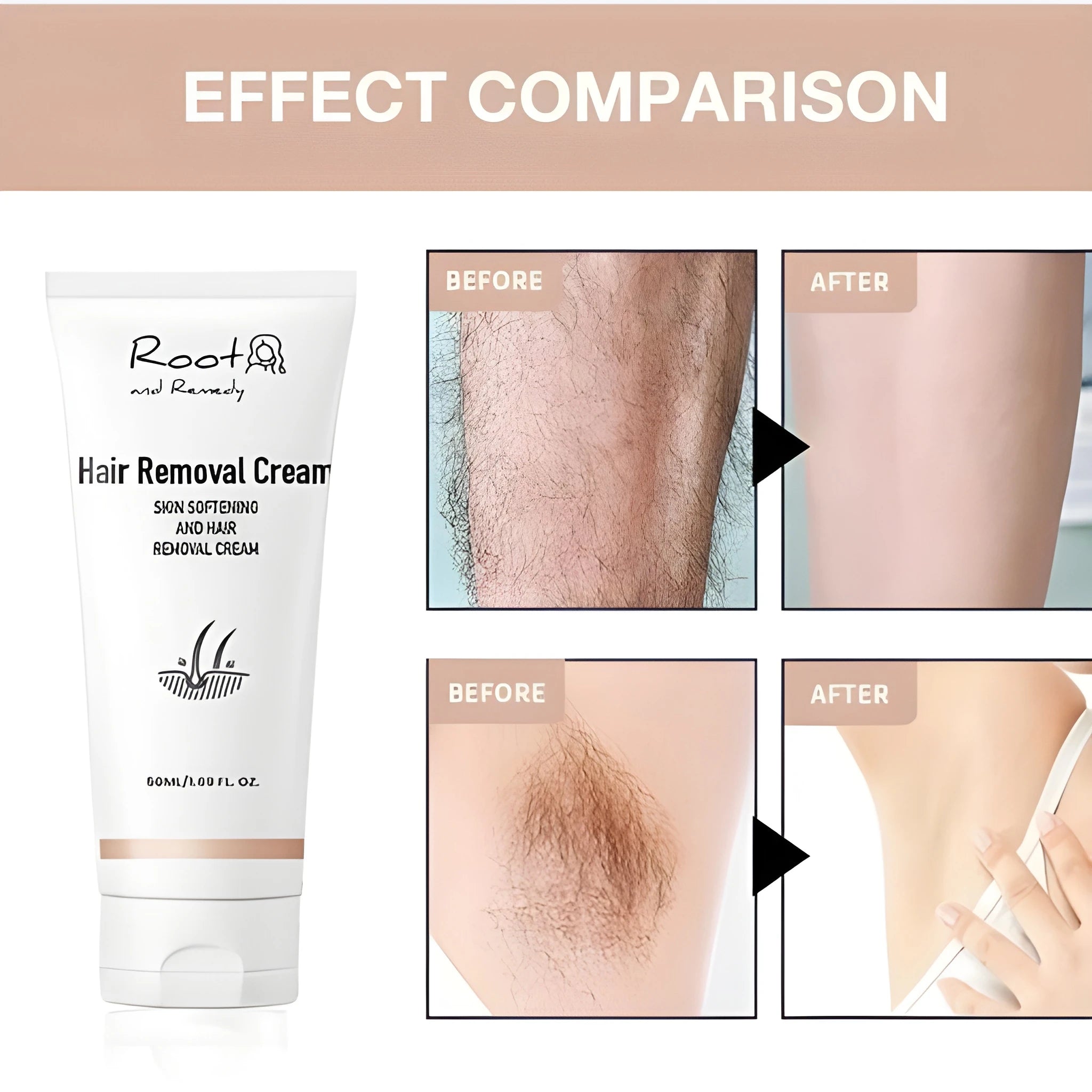 Soft Touch Hair Remover