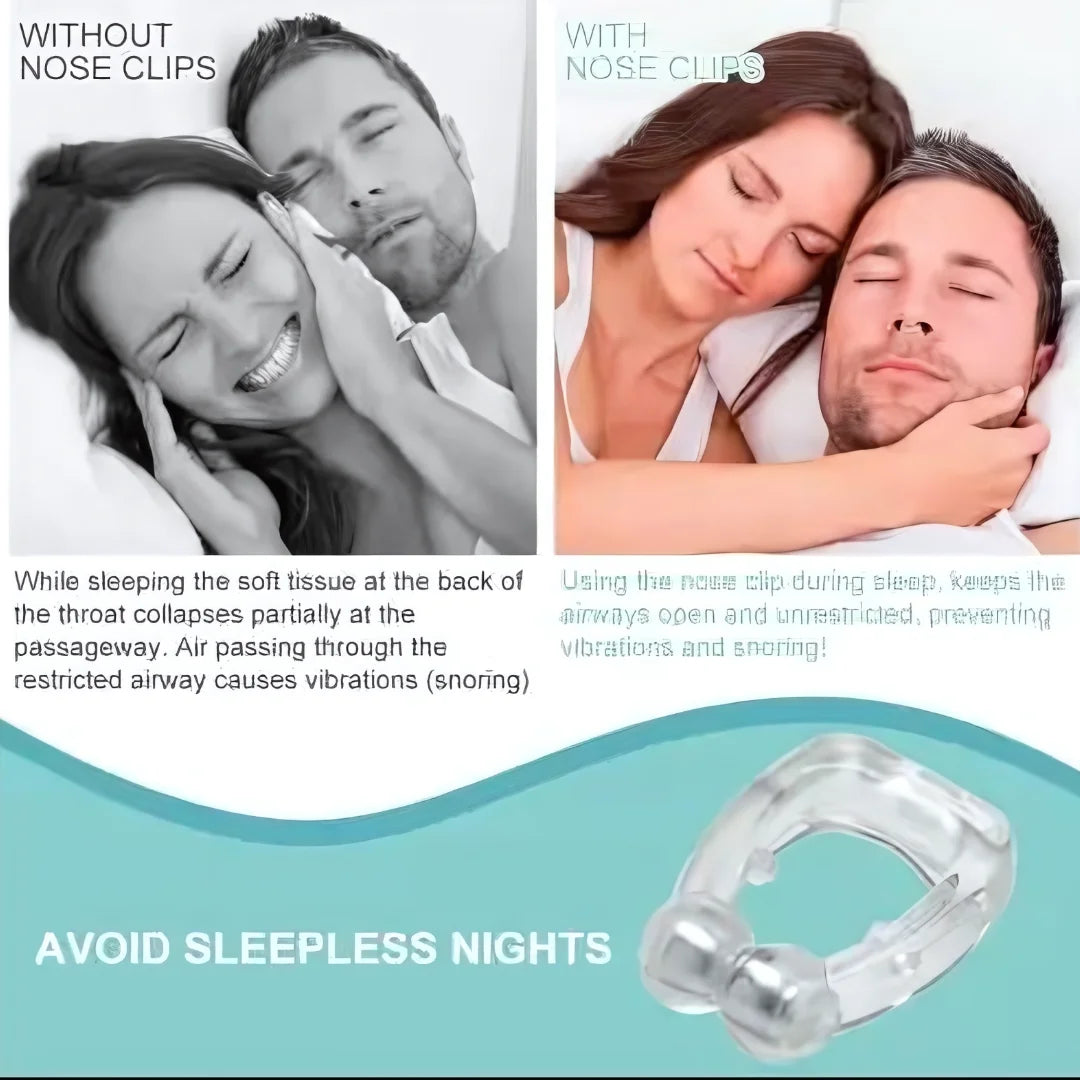 Anti Snoring Nose Clip (BUY 1 GET 1 FREE)