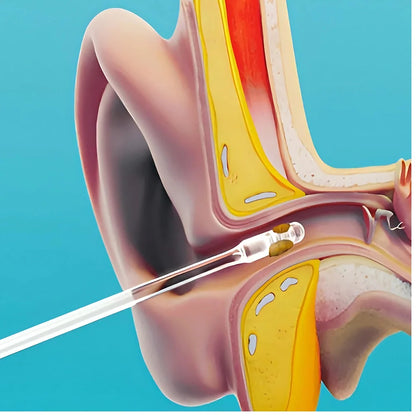 Reusable Ear Cleaning Sticks