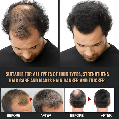 Root Activating Shampoo 200 ml Pack of 2