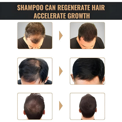 Root Activating Shampoo 200 ml Pack of 2