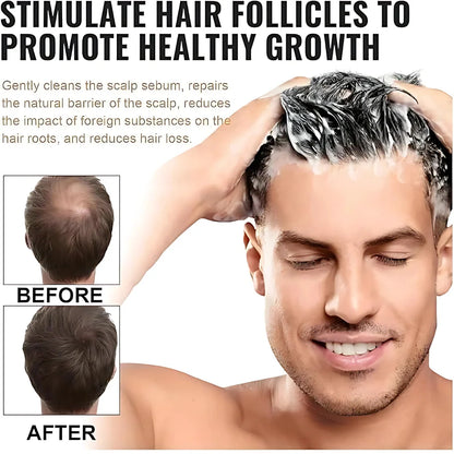 Root Stimulating Hair Shampoo