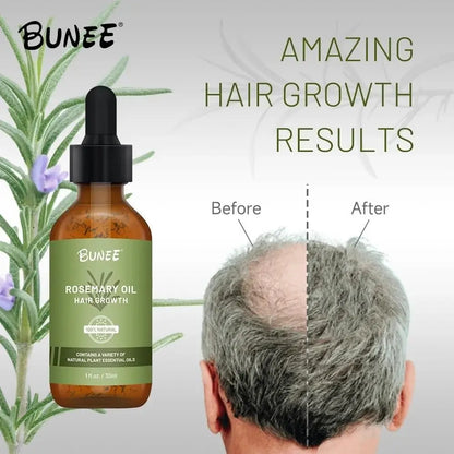Rosemary Hair Oil Serum – 30ml