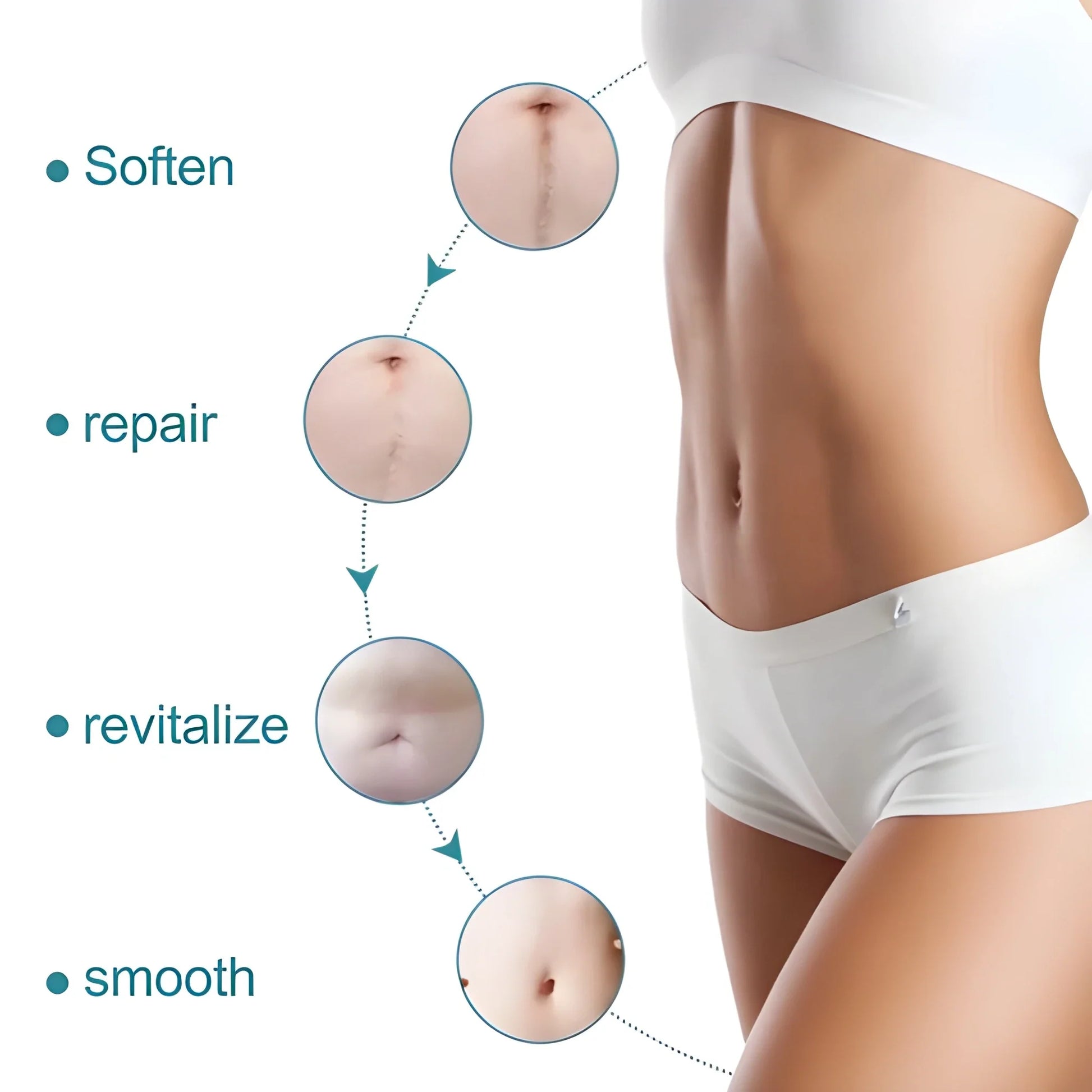 Silicone Scar Sheets – Soft Reusable Skin Friendly Tape Roll (4cm × 1.5m)