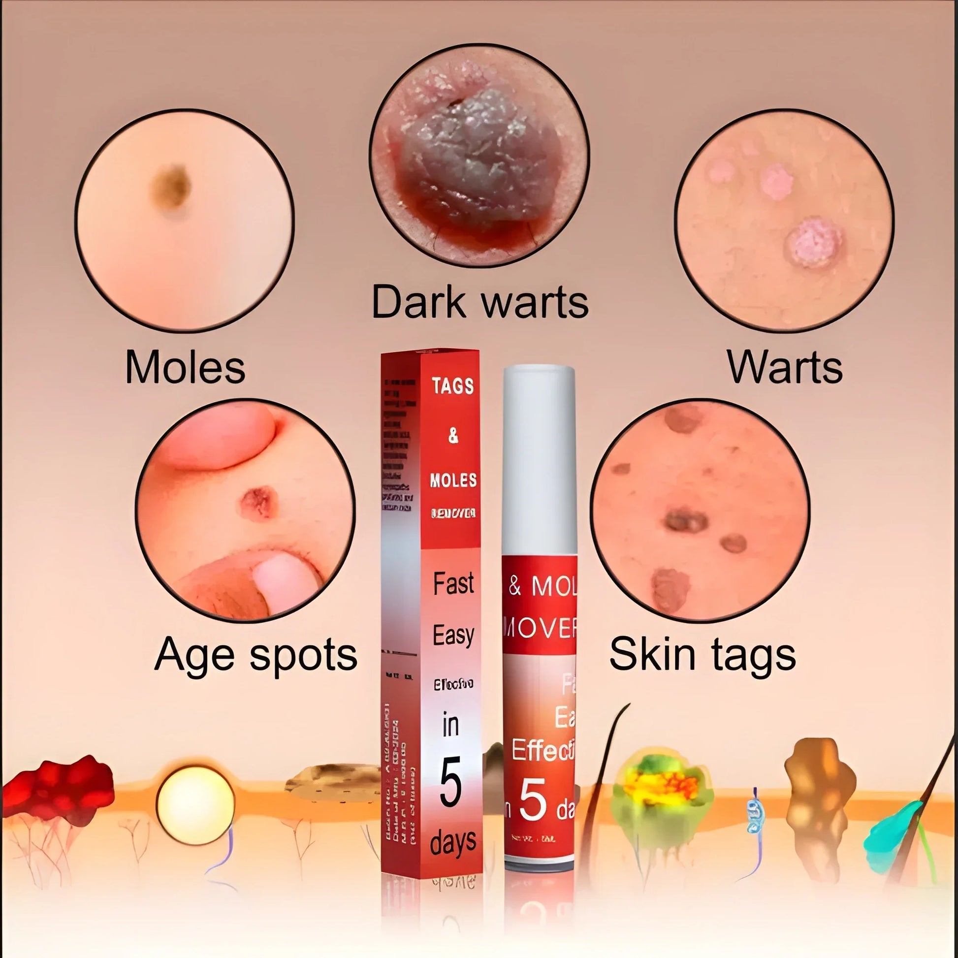Skin Tag Remover Cream