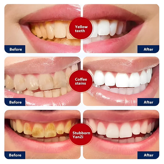 Smoke Stain Toothpaste – 200g x 2