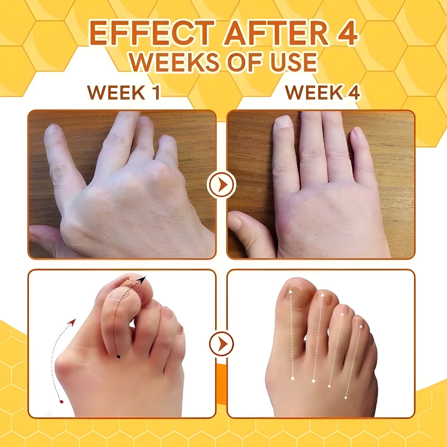 Spider Vein Reducing Spray