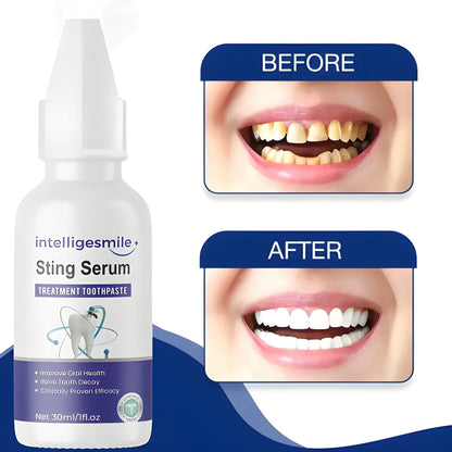 Sting Serum Whitening Toothpaste