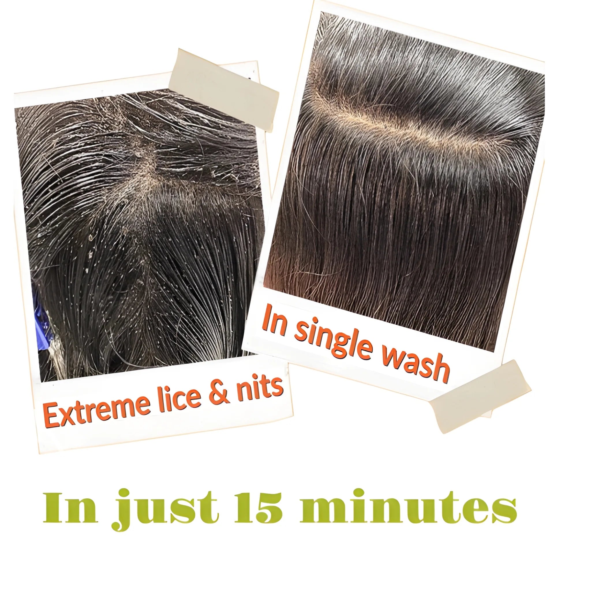 Tea Tree Lice Shampoo