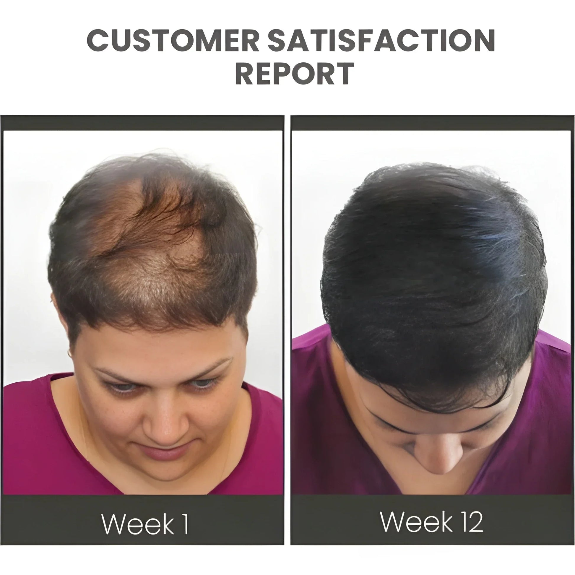 Thickening Hair Growth Spray