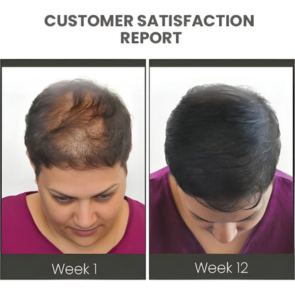 Thickening Hair Growth Spray