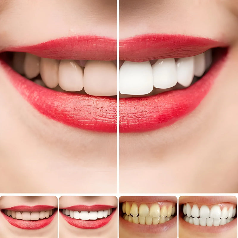 Brightening & Stain Removing Toothpaste