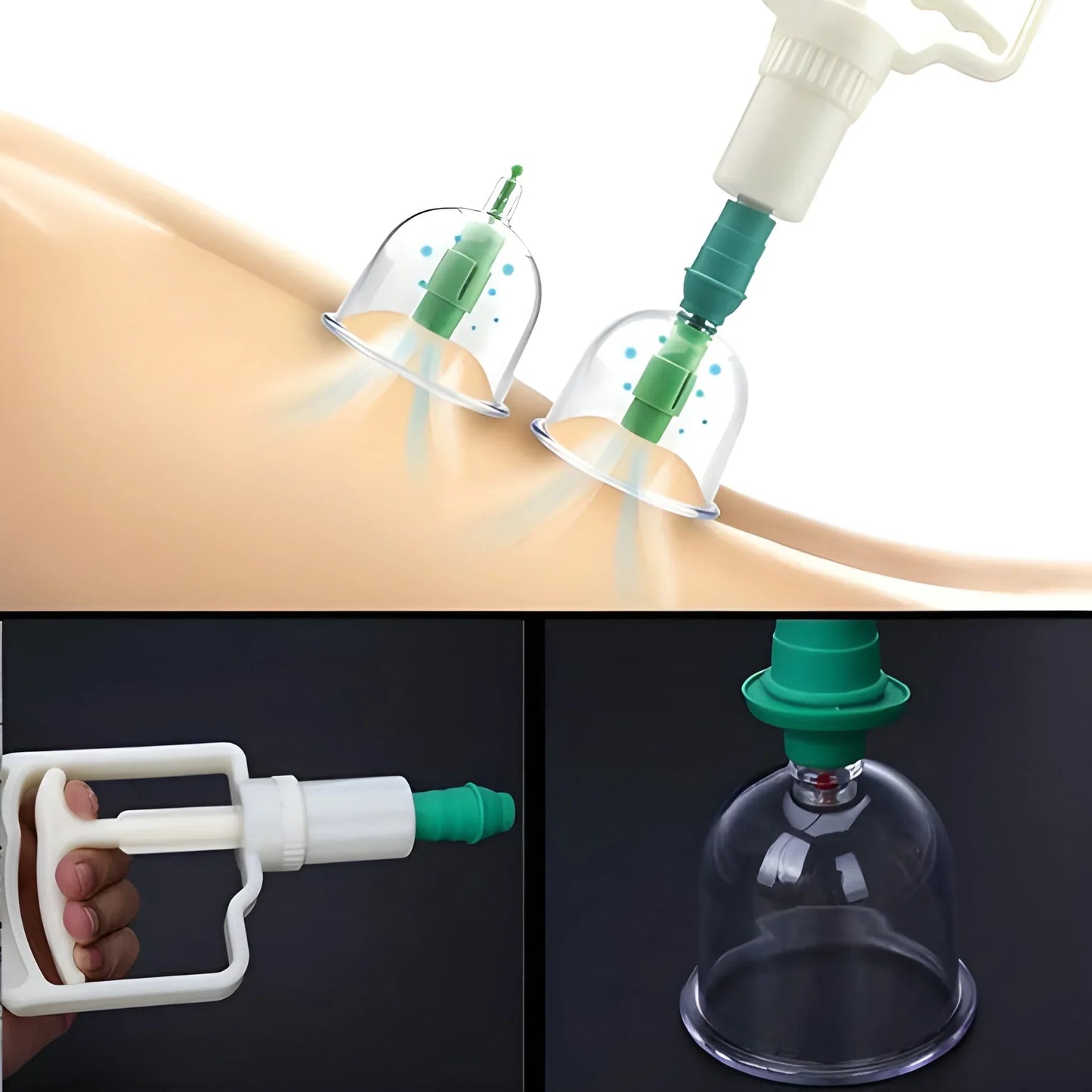 Best vacuum cupping set 6 pcs kit - health & beauty | 2025 | fast shipping