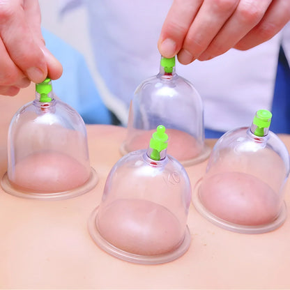 Best vacuum cupping set 6 pcs kit - health & beauty | 2025 | fast shipping