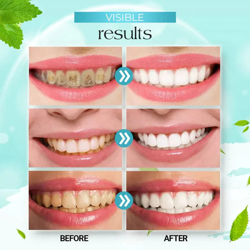 Teeth Whitening Foam Toothpaste