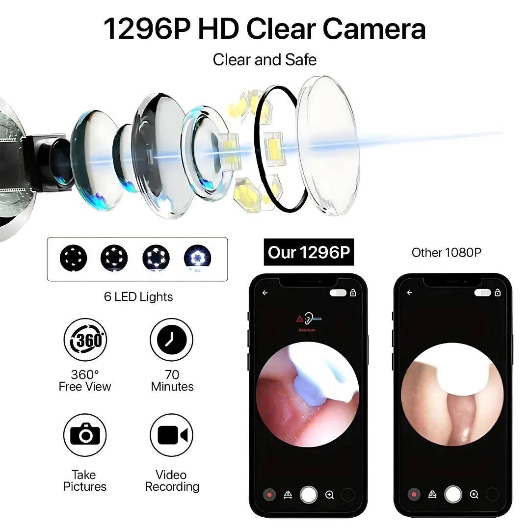 Wireless Ear Cleaner with Camera