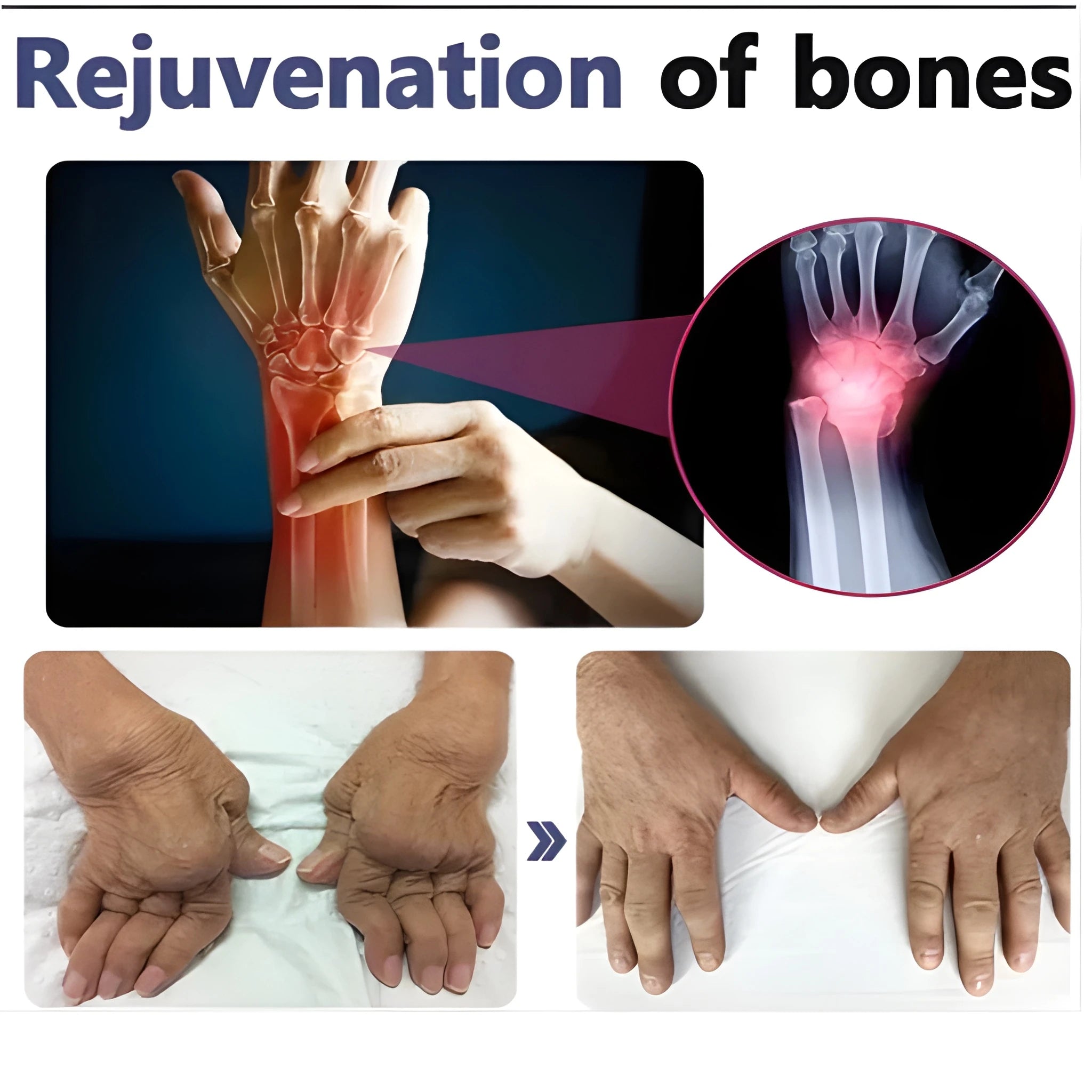 Bee Venom Joint Relief